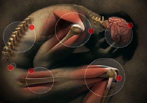 Apprenez à réaliser votre baume au cannabis photo zones de douleurs apprenez a realiser votre baume au cannabis
