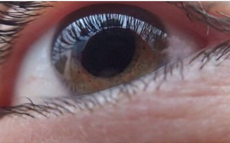 Cannabis thérapeutique